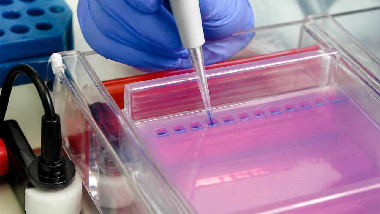 Loading a sample with a micropipette — steady hand, tip just above the well.